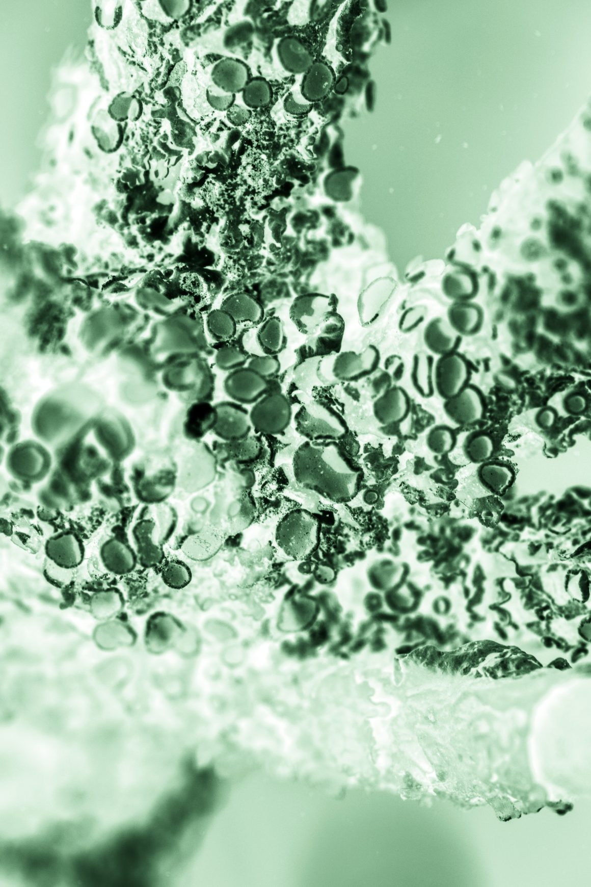 fabian-bachli-acido hialuronico