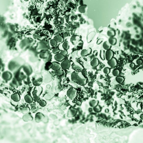 fabian-bachli-acido hialuronico